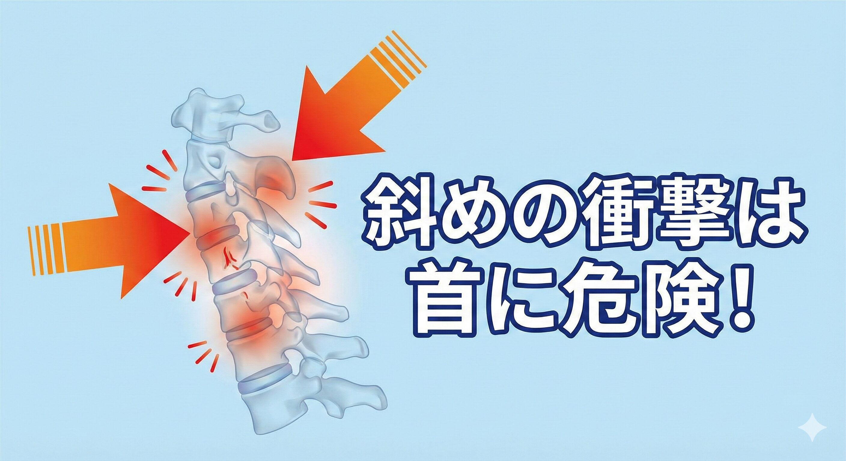 車線変更事故特有の「側方むちうち」のメカニズム。斜めからの衝撃が首の関節に大きな負担をかける様子を描いたインフォグラフィック。